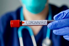 9 kwietnia: raport w sprawie koronawirusa