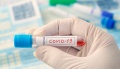 Znamy wyniki testów na Covid-19 pracowników Przychodni Rejonowej