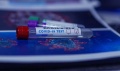 Niebieski Parasol. Trwają kolejne badania. Na miejscu pracują wyspecjalizowane służby